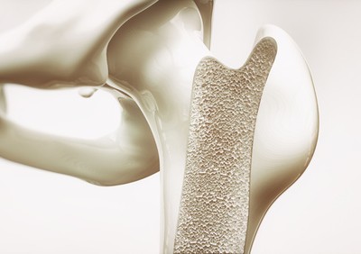 Knochendichtemessung